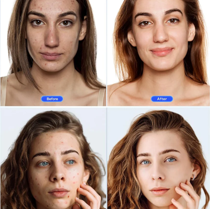 MaskLux – Máscara LED Rejuvenecedora Inteligente✨💆‍♀️💡🌸 + Cuello (7 colores)🔴🔵🟣🟡🟢⚪